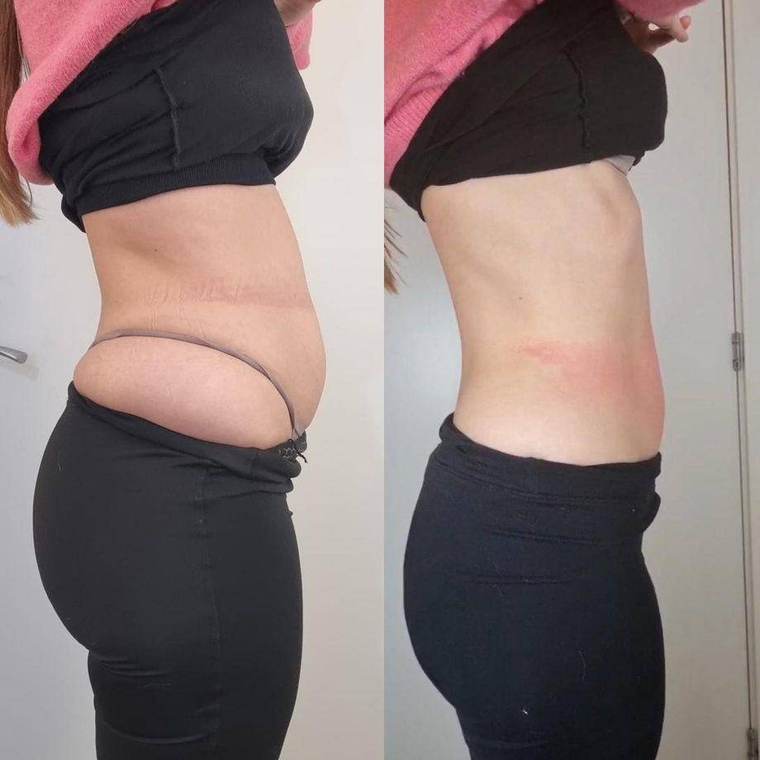Before and after