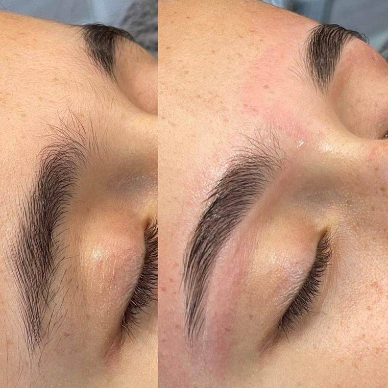 Before and after