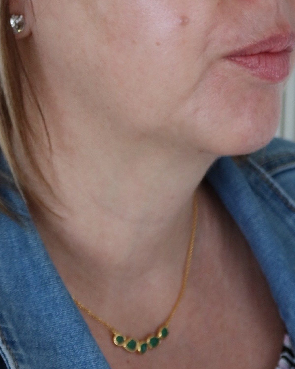 Sophie &middot; jawline & neck — before