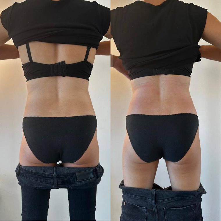 Before and after
