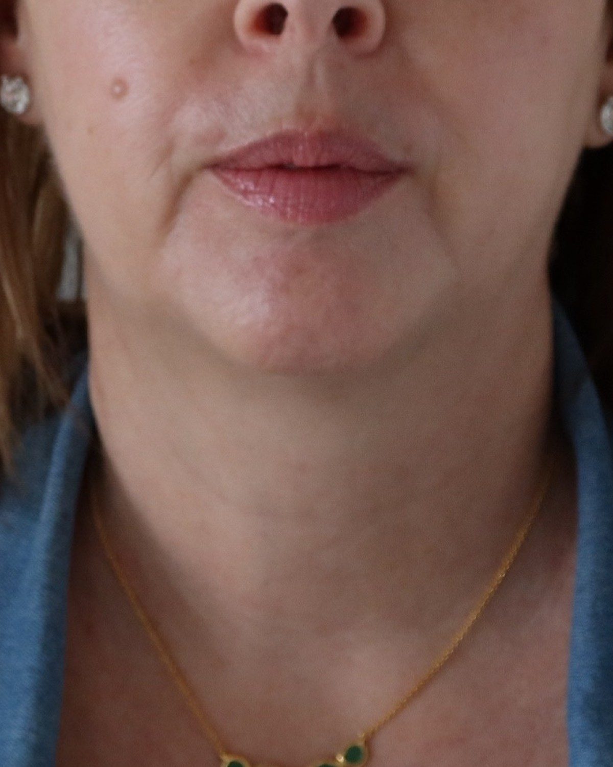 Sophie &middot; lower face<span class=