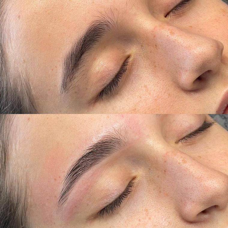 Before and after