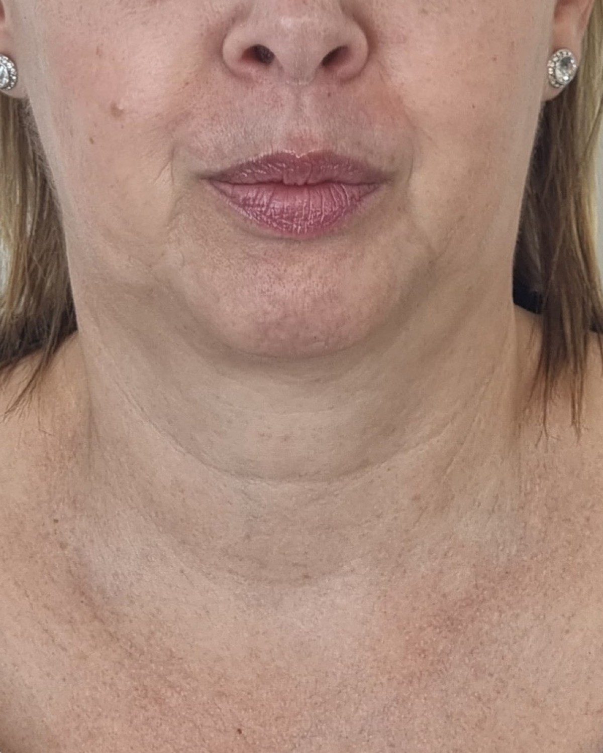 Sophie &middot; lower face<span class=